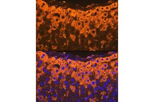 Immunofluorescence analysis of rat liver using Alpha-2-Macroglobulin (Alpha-2-Macroglobulin (M)) Rabbit mAb (ABIN7265558) at dilution of 1:100 (40x lens). (alpha 2 Macroglobulin antibody)