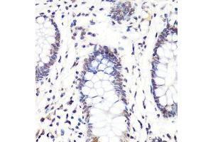 Immunohistochemistry of paraffin-embedded human colon using H3R2me2a antibody. (Histone 3 antibody  (H3R2me2))