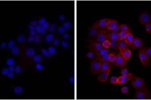 Human pancreatic carcinoma cell line MIA PaCa-2 was stained with Mouse Anti-Human CD44-UNLB, and DAPI. (Donkey anti-Mouse IgG (Heavy & Light Chain) Antibody (PE) - Preadsorbed)