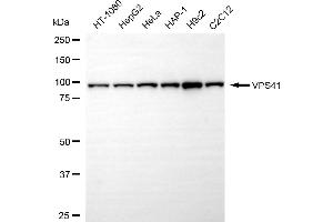 Western blotting analysis using VPS41 antibody (ABIN7800815). (Recombinant VPS41 antibody)