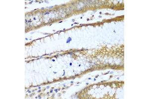 Immunohistochemistry of paraffin-embedded human stomach using ROCK1 antibody (ABIN5974704) at dilution of 1/100 (40x lens).