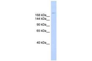 Image no. 1 for anti-Dysferlin (DYSF) (AA 215-264) antibody (ABIN6743370) (Dysferlin antibody  (AA 215-264))