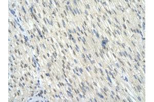 Rabbit Anti-KLF10 antibody        Paraffin Embedded Tissue:  Human Heart cell   Cellular Data:  Epithelial cells of renal tubule  Antibody Concentration:   4. (KLF10/TIEG1 antibody  (C-Term))