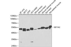 Western blot analysis of extracts of various cell lines, using EEF1 antibody (473) at 1:1000 dilution. (EEF1A2 antibody  (AA 184-463))