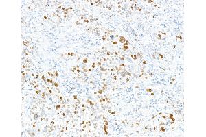Immunohistochemistry (IHC) image for anti-Minichromosome Maintenance Complex Component 2 (MCM2) (pSer108) antibody (ABIN7449366)