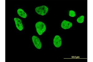 Immunofluorescence of purified MaxPab antibody to HNRNPL on HeLa cell. (HNRNPL antibody  (AA 1-558))