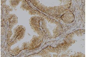 ABIN6278644 at 1/100 staining Mouse colon tissue by IHC-P.