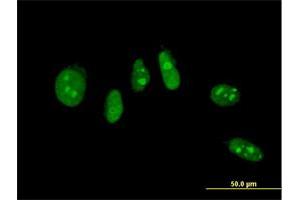 Immunofluorescence of monoclonal antibody to NHLH2 on HeLa cell. (NHLH2 antibody  (AA 36-135))