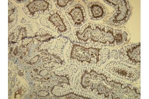 Immunohistochemistry (IHC) image for anti-B-Raf proto-oncogene, serine/threonine kinase (BRAF) antibody (ABIN7598779) (BRAF antibody)