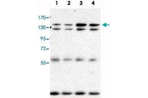 Immunoprecipitation and Western blot analysis in Lane 1: parental BaF3 cells, Lane 2: BaF3+BCR-ABL (BaF3 cells transduced with BCR-ABL), Lane 3: BaF3+BCR-ABL+mAhi-I (M1, BaF3 cells transduced with both BCR-ABL and mouse Ahi-1, M1 is a clonal cell line), Lane 4: BaF3+BCR-ABL+mAhi-1 (C2, BaF3 cells transduced with both BCR-ABL and mouse Ahi-1, C2 is a clonal cell line) with Ahi1 monoclonal antibody, clone 645s3 .