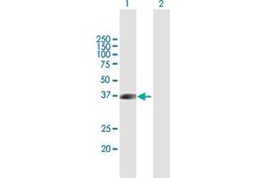 Western Blot analysis of FLCN expression in transfected 293T cell line by FLCN MaxPab polyclonal antibody. (FLCN antibody  (AA 1-342))