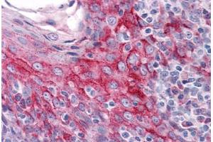 Human Tonsil: Formalin-Fixed, Paraffin-Embedded (FFPE) (ZMYM4 antibody  (C-Term))