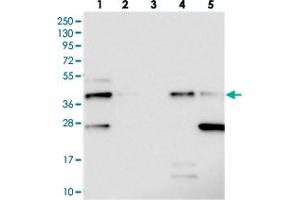 Western blot analysis of Lane 1: RT-4, Lane 2: U-251 MG, Lane 3: Human Plasma, Lane 4: Liver, Lane 5: Tonsil with C19orf66 polyclonal antibody  at 1:250-1:500 dilution.