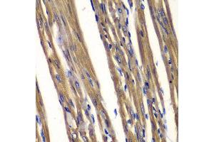 Immunohistochemistry (IHC) image for anti-Protein tyrosine Phosphatase, Non-Receptor Type 2 (PTPN2) (AA 1-353) antibody (ABIN3022585) (PTPN2 antibody  (AA 1-353))