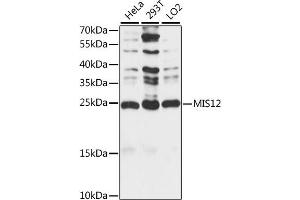 Western blot analysis of extracts of various cell lines, using MIS12 antibody (ABIN7268546) at 1:1000 dilution. (MIS12 antibody  (AA 1-205))