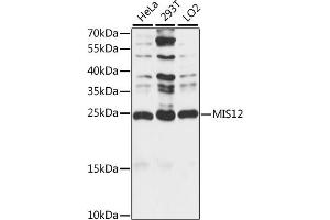 Western blot analysis of extracts of various cell lines, using MIS12 antibody (ABIN7268546) at 1:1000 dilution. (MIS12 antibody  (AA 1-205))