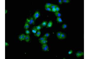 Immunofluorescence staining of HepG2 cells with ABIN7165254 at 1:100, counter-stained with DAPI. (DLK1 antibody  (AA 24-303))