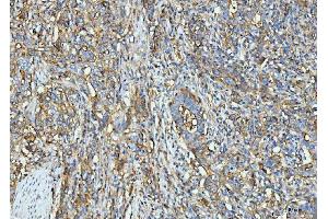 IHC analysis of ICAM1 using anti-ICAM1 antibody (ABIN7601066). (ICAM1 antibody  (AA 28-268))