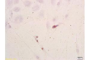 Neuroblastoma cells labeled with Anti-NSE/ENO2/? (ENO2/NSE antibody  (AA 201-300))