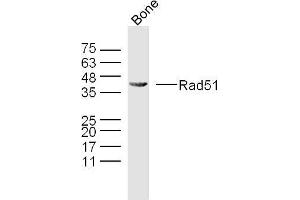 Mouse bone lysates probed with Rad51 Polyclonal Antibody, Unconjugated  at 1:300 overnight at 4˚C.