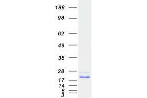 Validation with Western Blot (Cnrip1 Protein (Myc-DYKDDDDK Tag))