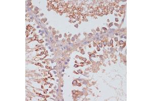 Immunohistochemistry of paraffin-embedded rat testis using MRPL41 antibody (ABIN7268572) at dilution of 1:100 (40x lens). (MRPL41 antibody  (AA 1-137))