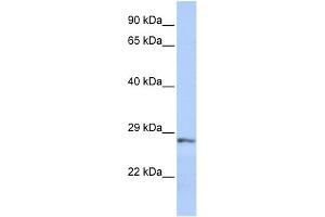 WB Suggested Anti-SFRP2 Antibody Titration: 0. (SFRP2 antibody  (Middle Region))