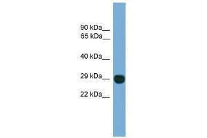 EIF4E2 antibody used at 0. (EIF4E2 antibody  (N-Term))