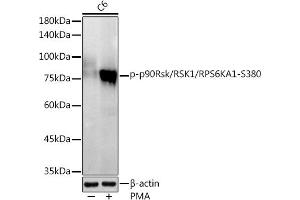 Western blot analysis of extracts of C6 cells, using Phospho-p90Rsk/RSK1/RPS6K-S380 antibody (ABIN7270036) at 1:1000 dilution. (RPS6KA1 antibody  (pSer380))