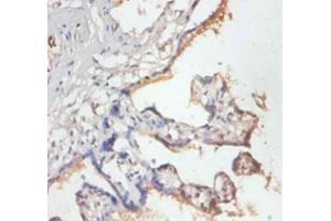 Immunohistochemistry of paraffin-embedded human placenta using MRPL19 antibody at dilution of 1:50. (MRPL19 antibody  (FITC))