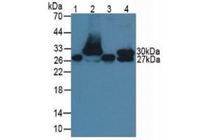 Figure. (TNNI1 antibody  (AA 1-187))