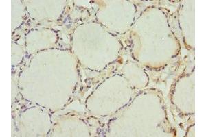 Immunohistochemistry of paraffin-embedded human thyroid tissue using ABIN7156244 at dilution of 1:100