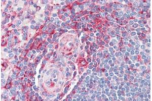 Human Spleen: Formalin-Fixed, Paraffin-Embedded (FFPE) (MVP antibody  (AA 1-894))