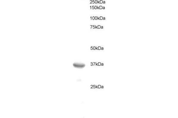 BCL7A antibody  (C-Term)