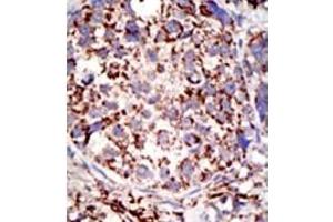 Image no. 2 for anti-Ubiquitin Specific Peptidase 3 (USP3) (C-Term) antibody (ABIN357524) (USP3 antibody  (C-Term))