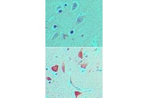 Image no. 1 for anti-Period Homolog 1 (Drosophila) (PER1) (AA 1150-1200) antibody (ABIN960303) (PER1 antibody  (AA 1150-1200))