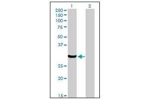 Western Blotting (WB) image for anti-Protein Kinase, Interferon-Inducible Double Stranded RNA Dependent Activator (PRKRA) antibody (ABIN781891) (PRKRA antibody)