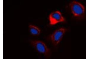 Immunofluorescent analysis of Phospholamban (pS16/T17) staining in HuvEc cells. (Phospholamban antibody  (N-Term, pSer16, pSer17))
