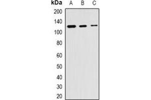 Western blot analysis of SKIV2L2 expression in Hela (A), mouse kidney (B), mouse testis (C) whole cell lysates.