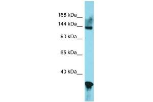 Western Blotting (WB) image for anti-GLI Family Zinc Finger 2 (GLI2) (Middle Region) antibody (ABIN2777474)