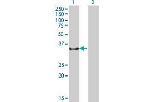 Western Blot analysis of NCR1 expression in transfected 293T cell line ( H00009437-T01 ) by NCR1 MaxPab polyclonal antibody. (NCR1 antibody  (AA 22-303))