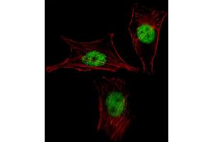 Fluorescent image of NIH-3T3 cell stained with MEOX2 Antibody . (MEOX2 antibody  (AA 164-192))