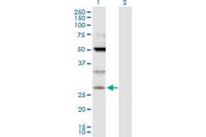 Western Blot analysis of TPD52 expression in transfected 293T cell line by TPD52 MaxPab polyclonal antibody. (TPD52 antibody  (AA 1-184))