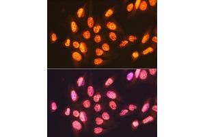 Immunofluorescence analysis of U-2 OS cells using ENT2/SLC29 Rabbit mAb (ABIN7270448) at dilution of 1:100 (40x lens). (SLC29A2 antibody)