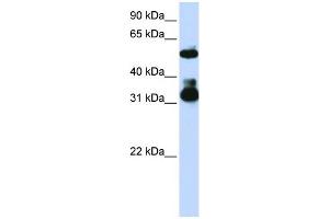 WB Suggested Anti-FBXW2  Antibody Titration: 0. (FBXW2 antibody  (Middle Region))