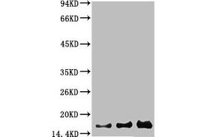 Western blot analysis of 1) Hela, 2) 293, 3) PC12 using Survivin Monoclonal Antibody. (Survivin antibody)