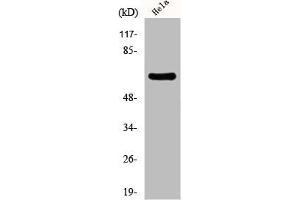 Western Blot analysis of HeLa cells using EAAT1 Polyclonal Antibody (SLC1A3 antibody  (C-Term))