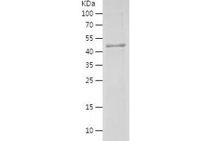 Western Blotting (WB) image for Folliculin (FLCN) (AA 364-579) protein (His-IF2DI Tag) (ABIN7122986) (FLCN Protein (AA 364-579) (His-IF2DI Tag))
