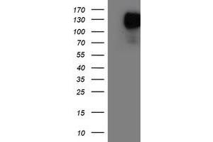 HEK293T cells were transfected with the pCMV6-ENTRY control (Left lane) or pCMV6-ENTRY ENPEP (Right lane) cDNA for 48 hrs and lysed. (ENPEP antibody)