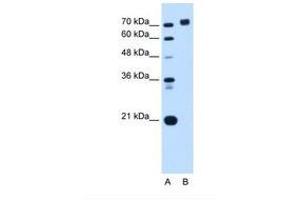 Image no. 1 for anti-Protein Tyrosine Phosphatase, Receptor Type, N (PTPRN) (AA 32-81) antibody (ABIN6738163) (PTPRN antibody  (AA 32-81))